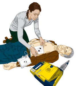 Diagram of woman using AED